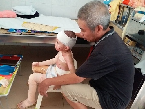 Hiện giờ bé Kem được bố và ông nội chăm sóc tại Hà Nội